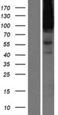 Western Blot: Heparan Sulfate Proteoglycan 2 Overexpression Lysate [NBP2-10461]