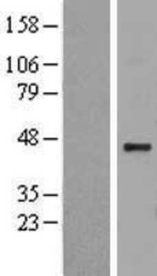 Western Blot: Heparan Sulfate 2-O-Sulfotransferase 1/HS2ST1 Overexpression Lysate [NBL1-11712]