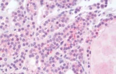 Immunohistochemistry-Paraffin: Heparanase/HPSE Antibody [NBP3-14371]