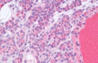 Immunohistochemistry-Paraffin: Heparanase/HPSE Antibody [NBP3-14372]