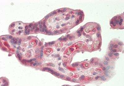 Immunohistochemistry-Paraffin: Heparanase/HPSE Antibody [NBP2-84064]