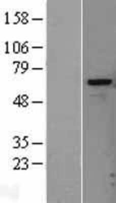 Western Blot: Heparanase/HPSE Overexpression Lysate [NBL1-11701]