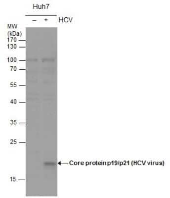 Western Blot: Hepatitis C Virus Core Antigen Antibody [NBP3-13008]