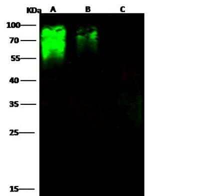 Western Blot: Hepatitis C Virus E2 Antibody [NBP3-12746]