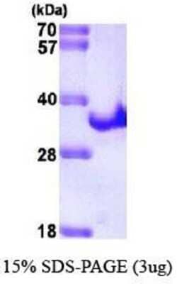 SDS-PAGE: Recombinant Hepatitis C Virus His Protein [NBP1-41149]