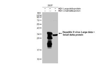 Western Blot: Hepatitis D Virus Large/Small Delta Antibody [NBP3-13461]