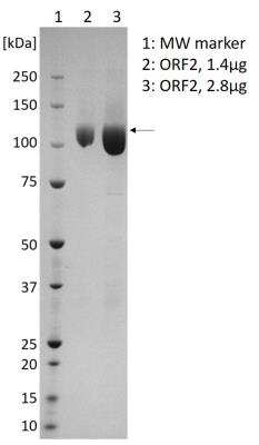 SDS-PAGE: Recombinant Virus Hepatitis E Virus Capsid Fc Protein [NBP3-14826]