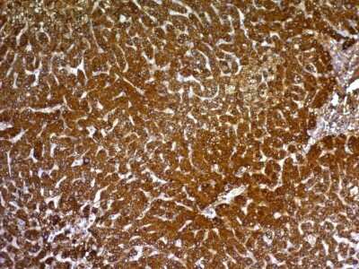 Immunohistochemistry-Paraffin: Hepatocyte Specific Antigen Antibody (HepPar1) - Azide and BSA Free [NBP3-08970]