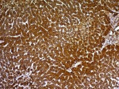Immunohistochemistry-Paraffin: Hepatocyte Specific Antigen Antibody (HepPar1) - IHC-Prediluted [NBP2-48068]