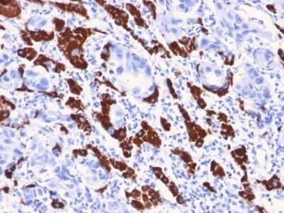 Immunohistochemistry-Paraffin: Hepatocyte Specific Antigen Antibody (OCH1E5) - Azide and BSA Free [NBP2-34699]