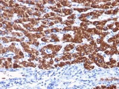 Immunohistochemistry-Paraffin: Hepatocyte Specific Antigen Antibody (OCH1E5) - Azide and BSA Free [NBP2-34699]