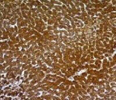Immunohistochemistry-Paraffin: Hepatocyte Specific Antigen Antibody (OCH1E5) - IHC-Prediluted [NBP2-45193]