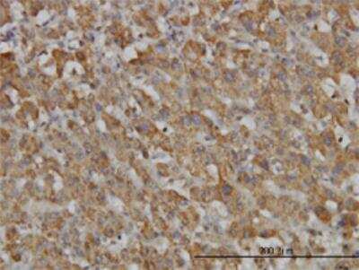 Immunohistochemistry-Paraffin: Hepcidin Antimicrobial Peptide Antibody (1F9) [H00057817-M02]