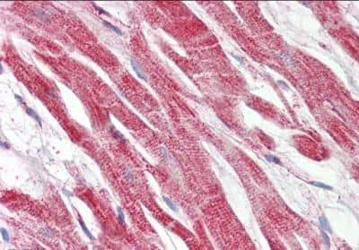 Immunohistochemistry-Paraffin: Hepcidin Antimicrobial Peptide Antibody [NBP1-36960]