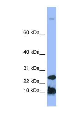 Western Blot: Hepcidin Antimicrobial Peptide Antibody [NBP1-59337]