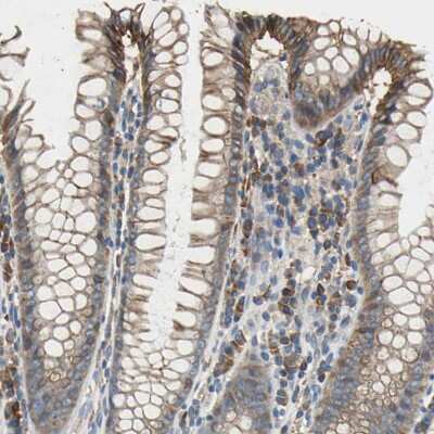 Immunohistochemistry-Paraffin: Hephaestin Antibody [NBP1-85483]