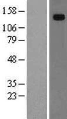 Western Blot: Hephaestin Overexpression Lysate [NBL1-11506]