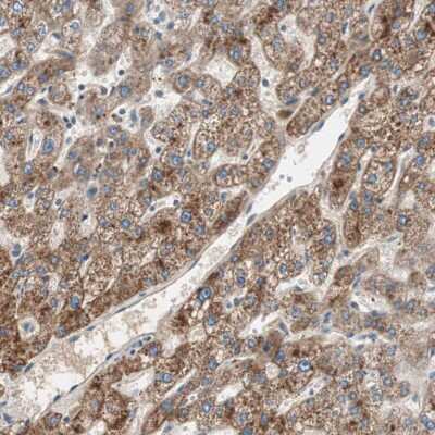 Immunohistochemistry-Paraffin: Hepsin Antibody [NBP1-86931]