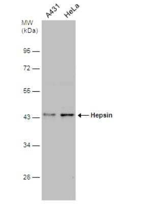 Western Blot: Hepsin Antibody [NBP2-16808]