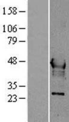 Western Blot: Hepsin Overexpression Lysate [NBL1-11694]