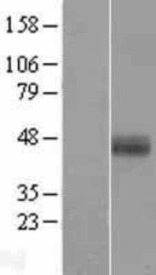 Western Blot: Hepsin Overexpression Lysate [NBL1-11695]