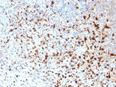 Immunohistochemistry-Paraffin: Herpes Simplex Virus 1 Antibody (10A3) - Azide and BSA Free [NBP3-08625]