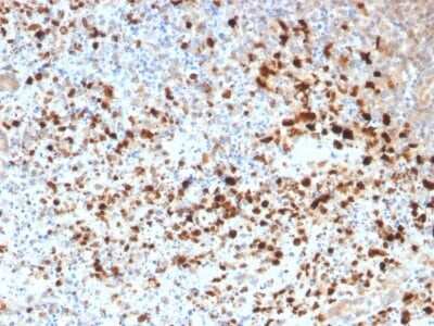 Immunohistochemistry-Paraffin: Herpes Simplex Virus 1 Antibody (HSV1/1934) - Azide and BSA Free [NBP3-08632]