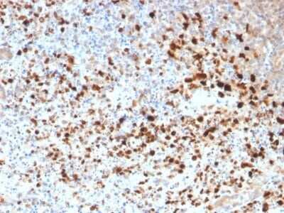 Immunohistochemistry-Paraffin: Herpes Simplex Virus 1 Antibody (HSV1/1934) [NBP3-07632]