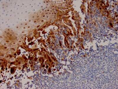 Immunohistochemistry-Paraffin: Herpes Simplex Virus 1 Antibody (HSV1/4055R) [NBP3-13913]