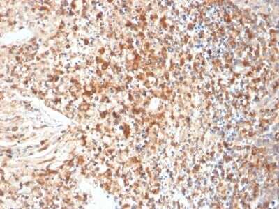 Immunohistochemistry-Paraffin: Herpes Simplex Virus 1 Antibody (HSVI/2095) - Azide and BSA Free [NBP3-08465]