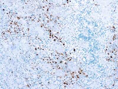 Immunohistochemistry-Paraffin: Herpes Simplex Virus 1 Antibody [NB120-933]