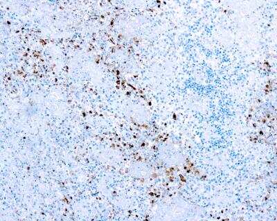 Immunohistochemistry-Paraffin: Herpes Simplex Virus 1 Antibody [NB120-9533]