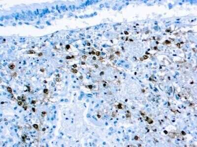 Immunohistochemistry-Paraffin: Herpes Simplex Virus 2 Antibody (DBM15.69) [NBP1-22810]