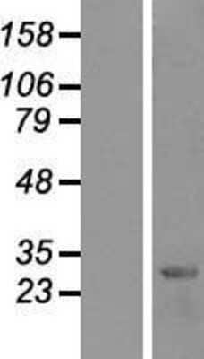 Western Blot: HES-1 Overexpression Lysate [NBP2-07738]