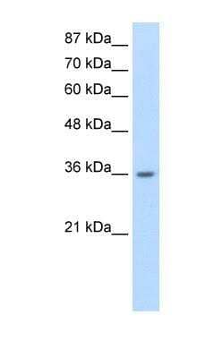 Western Blot: Heterogeneous Nuclear Ribonucleoprotein (A1-like) Antibody [NBP1-80446]