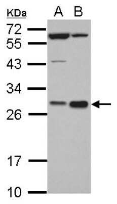 Western Blot: HHEX Antibody [NBP2-16811]