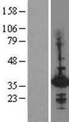 Western Blot: HHEX Overexpression Lysate [NBL1-11531]