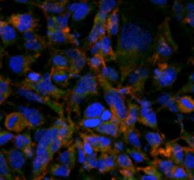 Immunocytochemistry/ Immunofluorescence: Hexanoyl-Lysine adduct Antibody (5E8) [NBP2-59363]