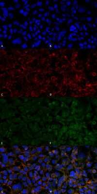 Immunocytochemistry/ Immunofluorescence: Hexanoyl-Lysine adduct Antibody (5E8) [NBP2-59363]
