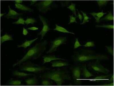 Immunocytochemistry/ Immunofluorescence: Hexim 1 Antibody (1H5) [H00010614-M10]