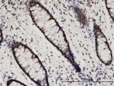 Immunohistochemistry-Paraffin: Hexim 1 Antibody (2D12) [H00010614-M02]