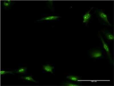 Immunocytochemistry/ Immunofluorescence: Hexim 1 Antibody (4G4) [H00010614-M01]