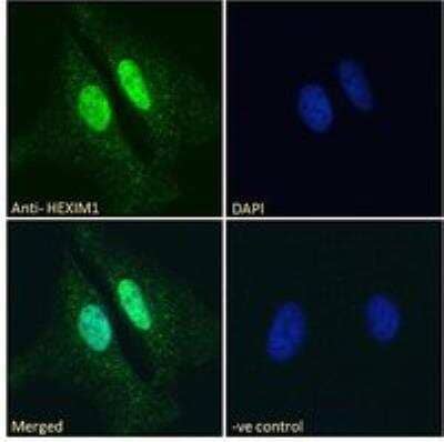 Immunocytochemistry/ Immunofluorescence: Hexim 1 Antibody [NB100-55391]