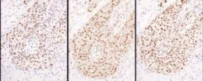 Immunohistochemistry: Hexim 1 Antibody [NBP1-71866]