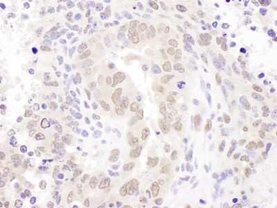 Immunohistochemistry: Hexim 1 Antibody [NBP1-71867]