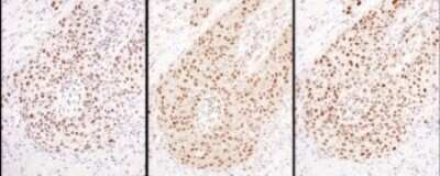 Immunohistochemistry: Hexim 1 Antibody [NBP1-71868]