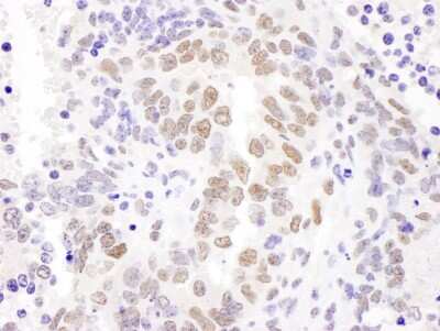 Immunohistochemistry: Hexim 1 Antibody [NBP1-71868]