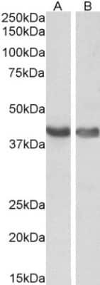 Western Blot: Hexim 1 Antibody [NB100-55391]