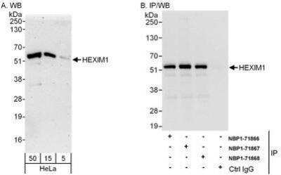 Western Blot: Hexim 1 Antibody [NBP1-71867]