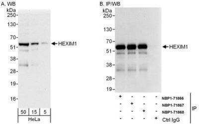 Western Blot: Hexim 1 Antibody [NBP1-71868]